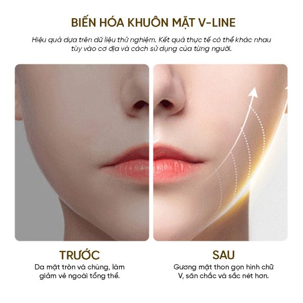 Máy Massager Thon Gọn Mặt VFace - Giải Pháp Làm Đẹp Công Nghệ Cao Tại Nhà - Hình ảnh 2