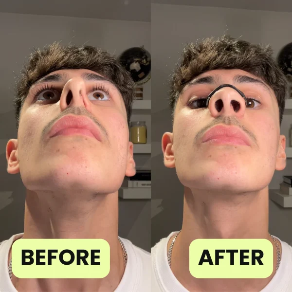 Trước và sau khi dùng miếng dán nở mũi chống ngáy oxybreathing